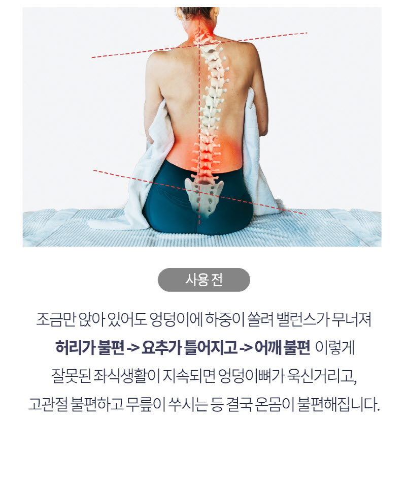 닥터쎈 얼음방석 1세트 상세 25