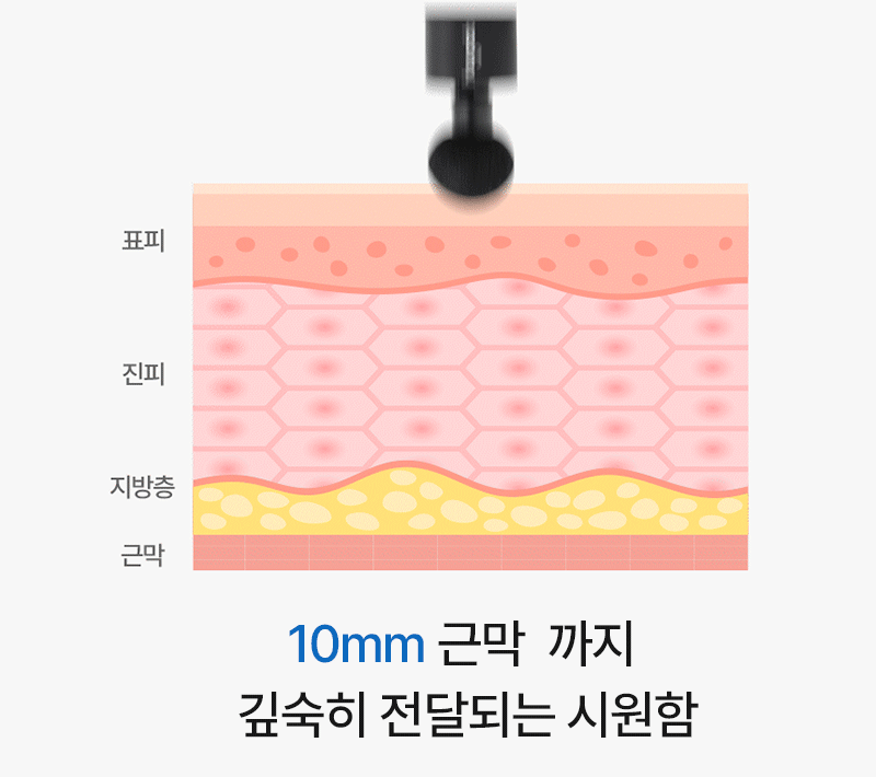 [휴플러스] 커브건 C20 상세 52
