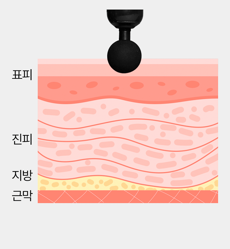 [휴플러스] 커브건 C20 상세 81