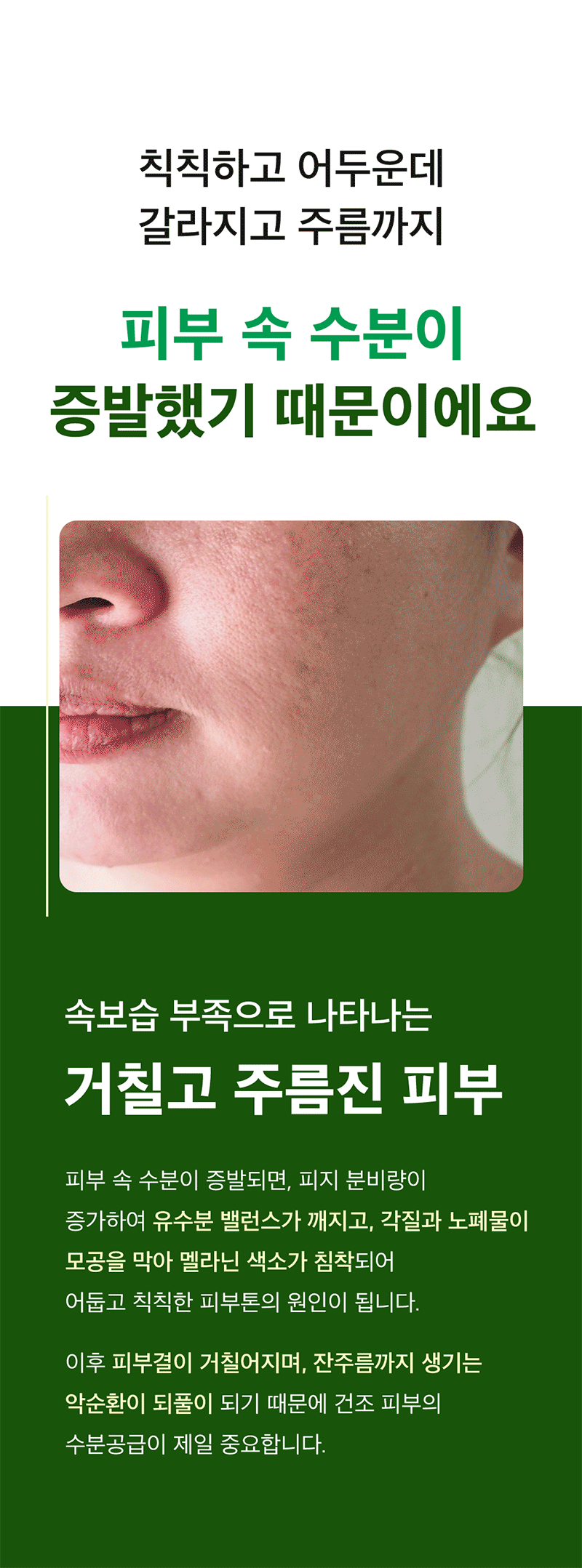 뷰망뜨 삼백초 미스트 상세 4